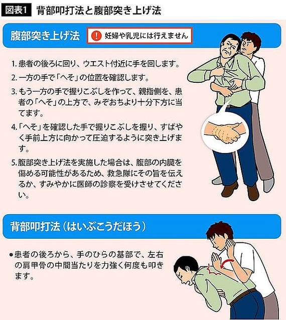 Step001